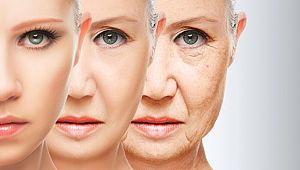 Cilt Sarkmasını Önlemenin Püf Noktaları