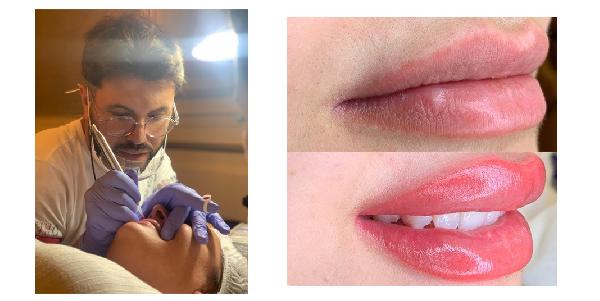 Güzellik Koçundan Dudakta Oluşan Pigment Kaybı İçin Öneriler