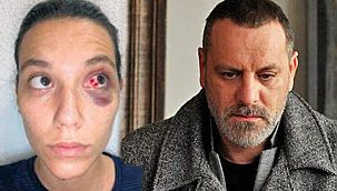 Magazin Dünyası Temmuz’da Ozan Güven’i Konuştu!