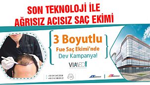 Son Teknoloji ile Ağrısız Acısız Saç Ekimi