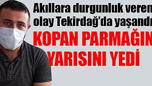 Aşçının parmağını yedi