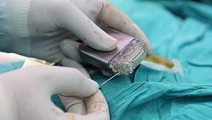 Beyin Pillerinin Yerini Musk'ın Çipi Mi Alacak?