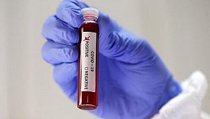 Almanya’dan cenazeye virüs getirdi