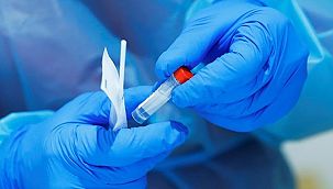 Fas'ta günlük vaka sayısı en yüksek seviyeye çıktı