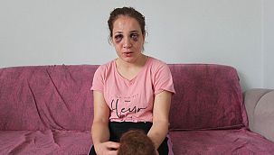 Kocası bu hale getirdi!