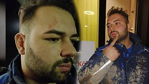 Türkiye'den sert tepki! Almanya'da Türk iş insanına saldırı