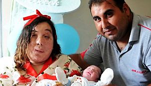 Yüz nakli beklerken aşık olup evlendiler