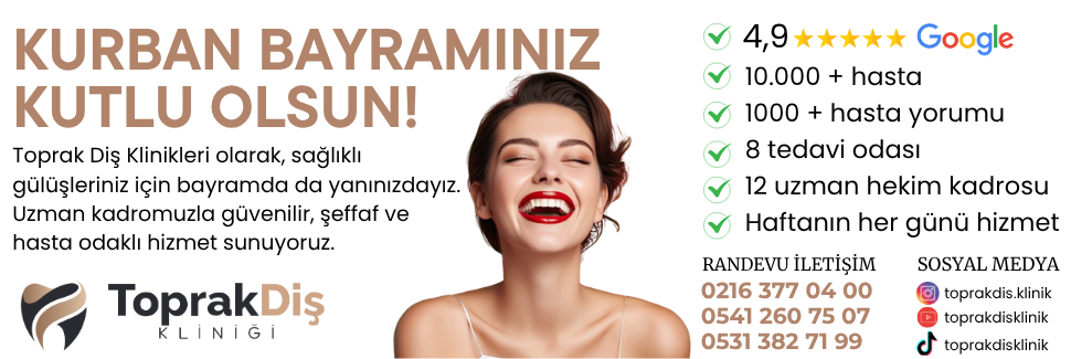Reklam